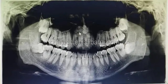 치과 CT 3D CBCT 디지털 X선 장비 중국